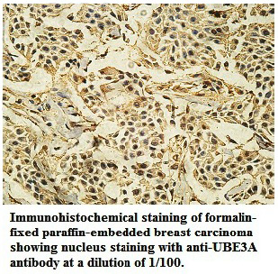 UBE3A Antibody