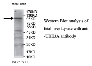 UBE3A Antibody