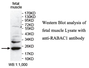 RABAC1 Antibody