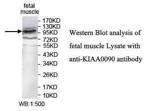 KIAA0090 Antibody