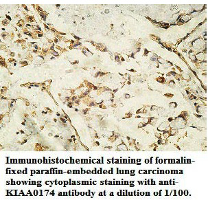 KIAA0174 Antibody