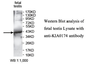 KIAA0174 Antibody