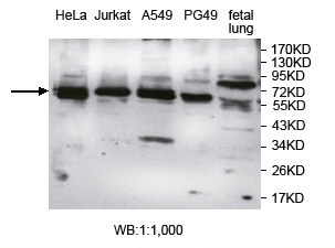 AGBL4 Antibody