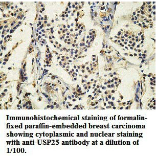 USP25 Antibody