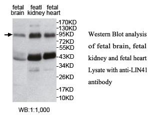 LIN41 Antibody