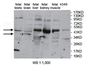 PKNOX1 Antibody