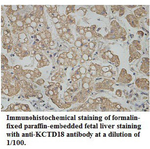 KCTD18 Antibody