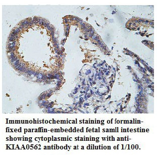 KIAA0562 Antibody