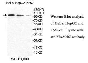 KIAA0562 Antibody