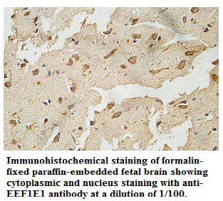 EEF1E1 Antibody