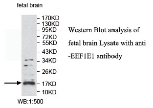 EEF1E1 Antibody