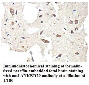 ANKRD29 Antibody