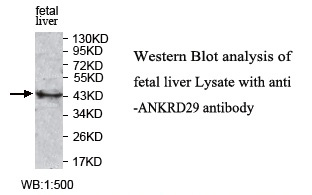 ANKRD29 Antibody