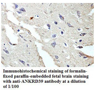 ANKRD39 Antibody