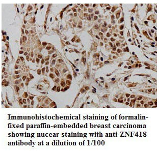 ZNF418 Antibody