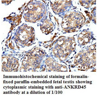 ANKRD45 Antibody