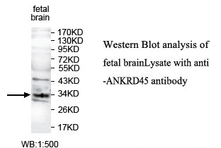 ANKRD45 Antibody