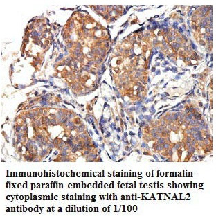 KATNAL2 Antibody