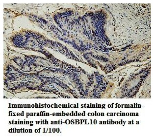 OSBPL10 Antibody