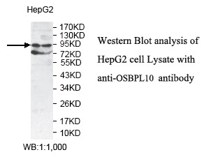 OSBPL10 Antibody