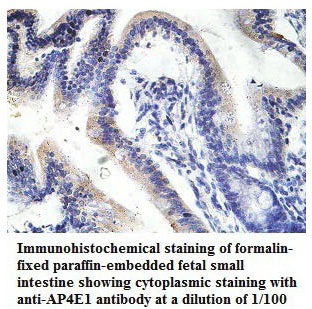 AP4E1 Antibody