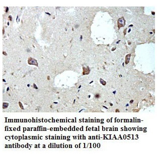 KIAA0513 Antibody