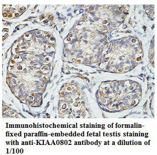 KIAA0802 Antibody