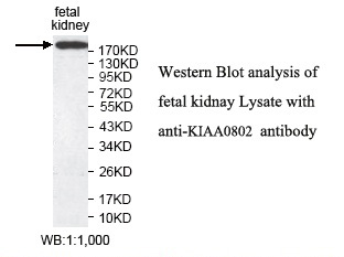 KIAA0802 Antibody