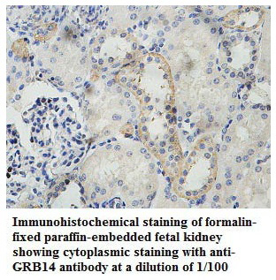 GRB14 Antibody