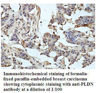 PLDN Antibody