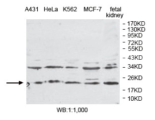 PLDN Antibody