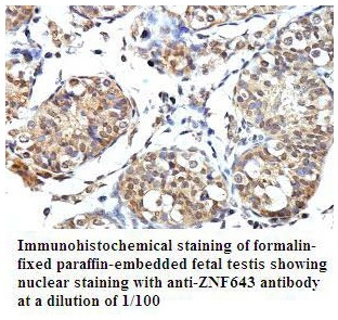 PLEKHJ1 Antibody