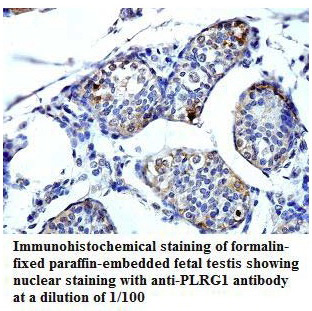 PLRG1 Antibody