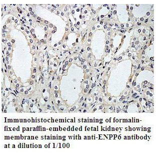 ENTPD1 Antibody