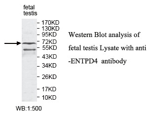 ENTPD1 Antibody