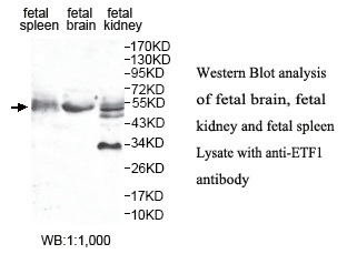 ETF1 Antibody