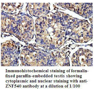 ZNF540 Antibody