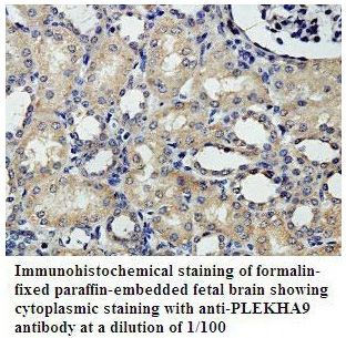 PLEKHA9 Antibody