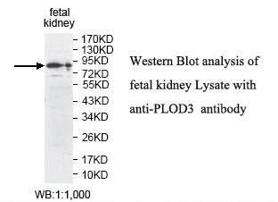 PLOD3 Antibody