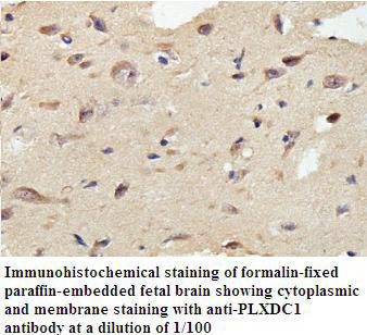 PLXDC1 Antibody