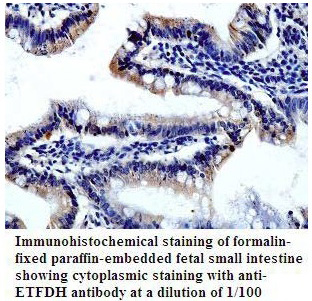 ETFDH Antibody