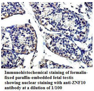 ZNF10 Antibody