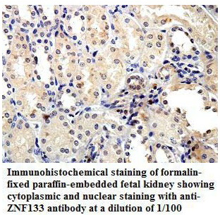 ZNF133 Antibody