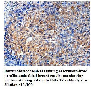 ZNF699 Antibody