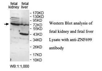 ZNF699 Antibody