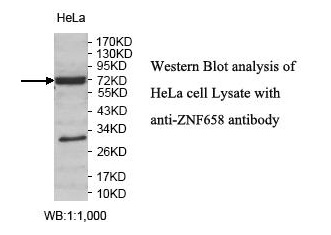 ZNF658 Antibody