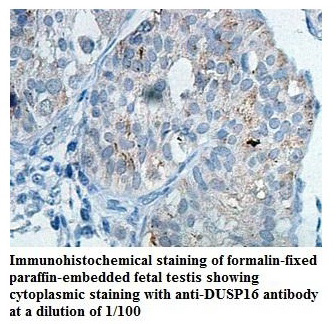 DUSP16 Antibody