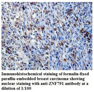 ZNF791 Antibody