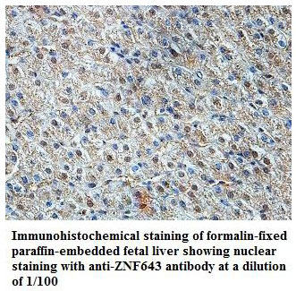 ZNF643 Antibody