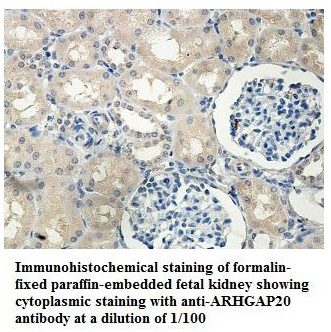 ARHGAP20 Antibody